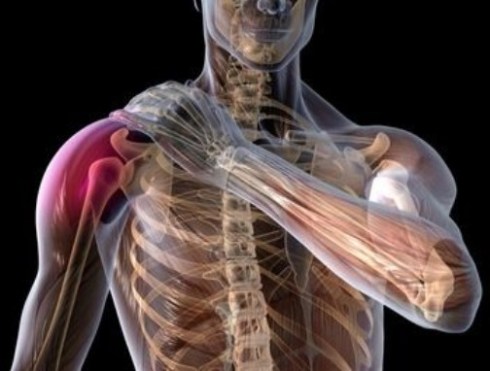 Shoulder Pain Shoulder Pain
